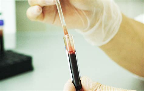Best Radiology and Pathology Labs in Sialkot .